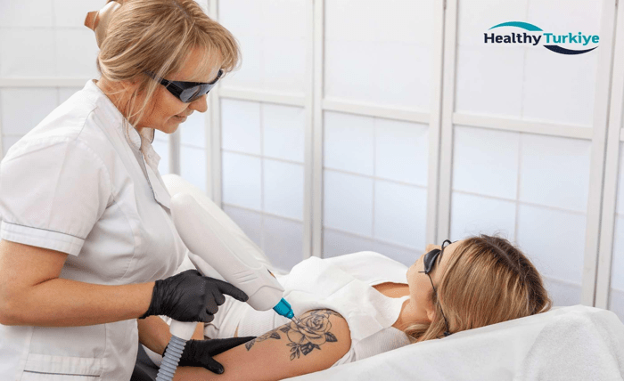 Tattoo Removal in Turkey with CO2 Laser Skin Resurfacing